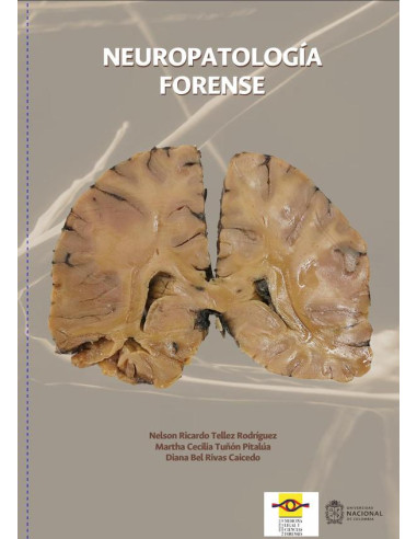 Neuropatología forense