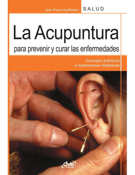 La acupuntura para prevenir y curar las enfermedades