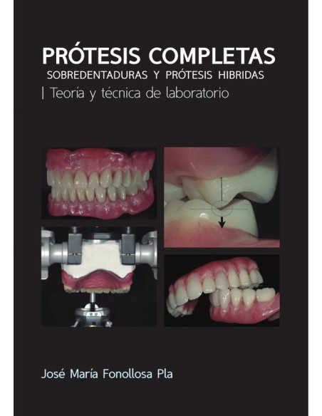 Prótesis Completas:Sobredentaduras y prótesis híbridas. Teoría y técnica de laboratorio