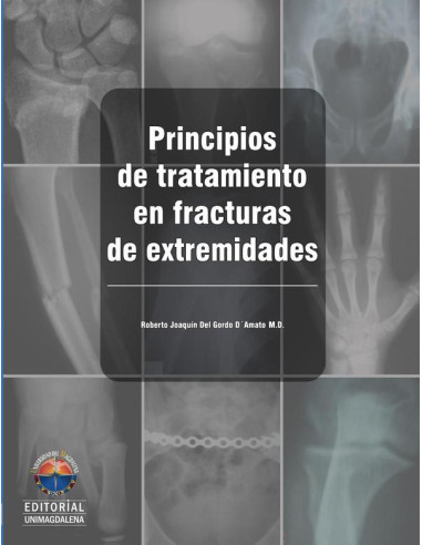 Principios de tratamiento en fracturas de extremidades