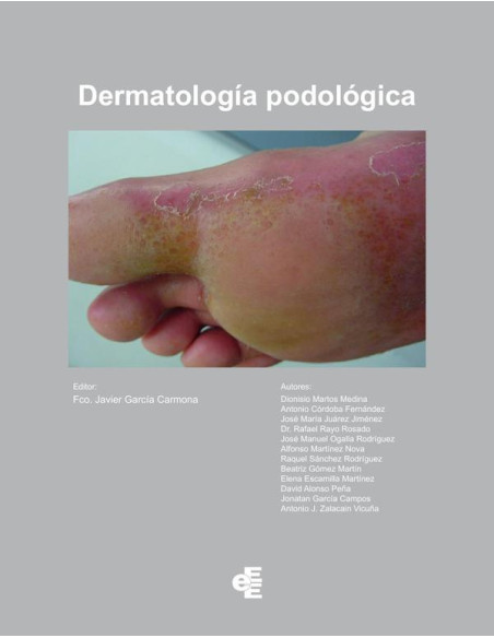 Dermatología Podológica