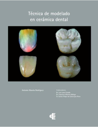 Técnica de modelado en cerámica dental