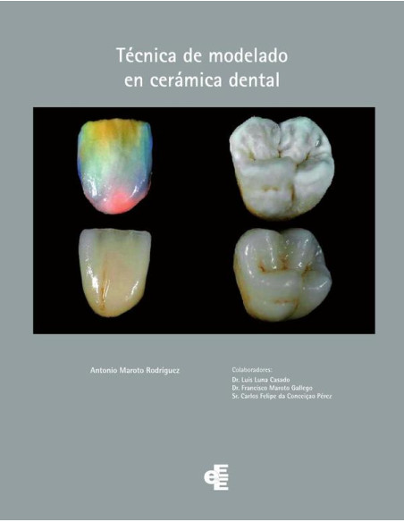 Técnica de modelado en cerámica dental